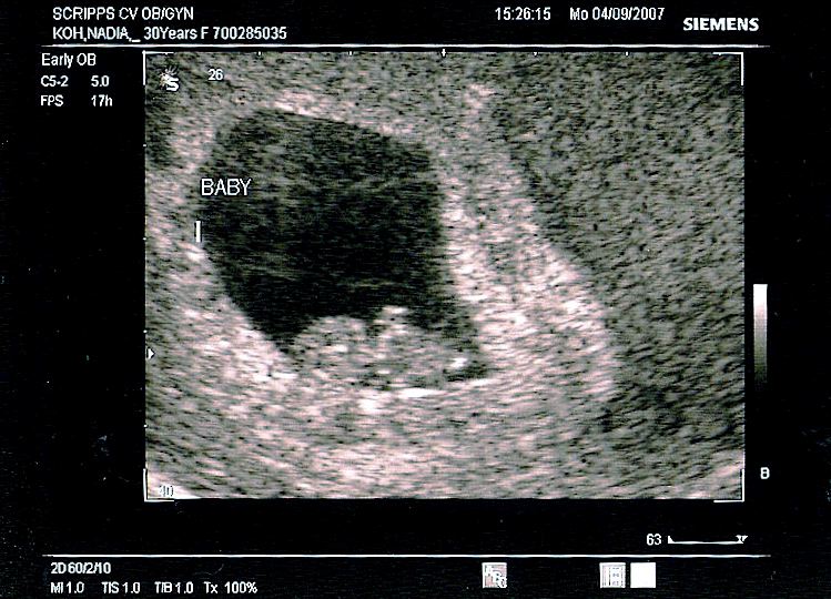 Thea Head, Body, Arms, and Tail Bone - 8 Weeks 