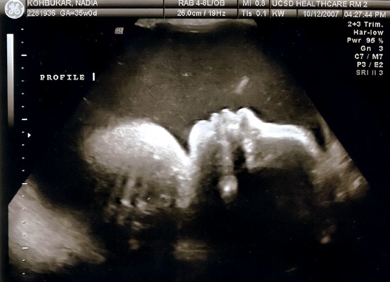 Thea's Profile - 35 Weeks