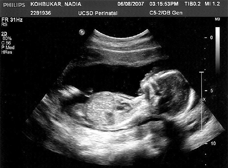 Thea Florencia Bukar Feb 2007 - Oct 2007