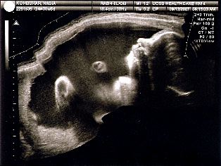 Thea's Profile - 30 Weeks
