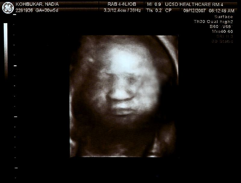 Thea 3D - 30 Weeks