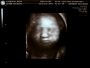 Thea 3D - 30 Weeks